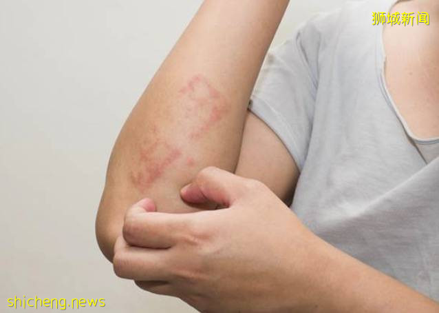 輝瑞/莫德納接種者，9403人副作用 過去三個月，驟增6千多起