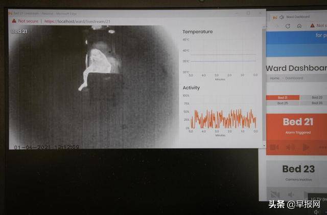 新加坡医院如何用人工智能防病患跌倒