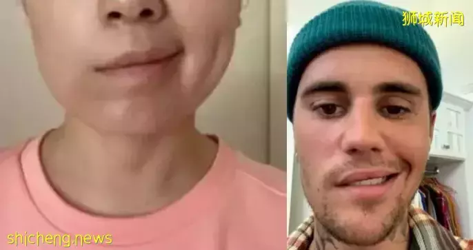 新加坡再發現一種後遺症！口齒不清、閉眼困難！3天後，一波新政出爐備戰"第5波"