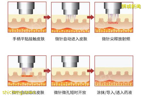新加坡童年女神隐婚10年，41岁嫁富豪老公，50岁美成了天仙