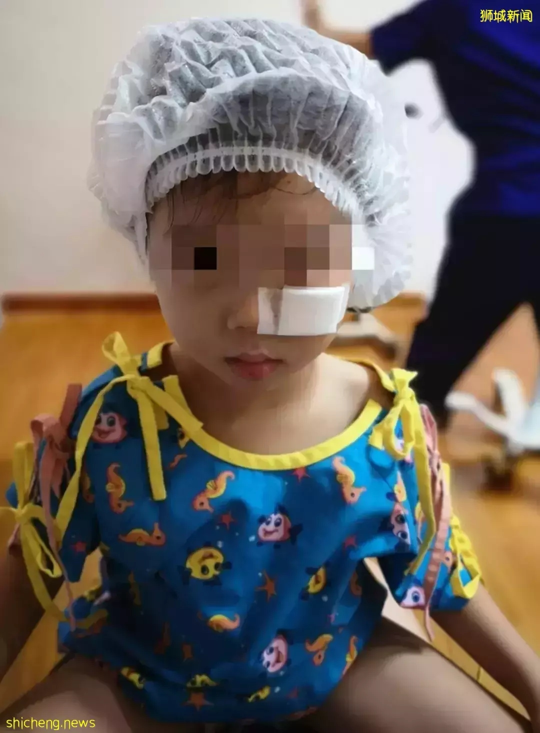 新加坡3歲女童被寵物孔雀啄傷，血流不止，臉上留下3厘米縫合線