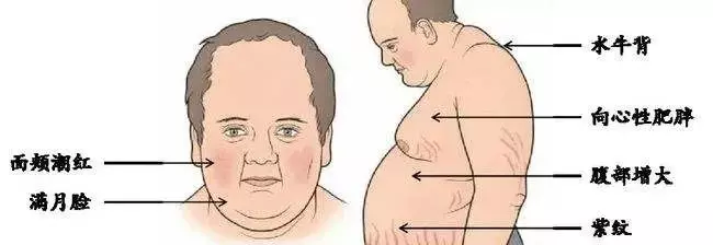 【HAS衛生科學局】這款“星星膏”買不得,嬰兒用後出現“月亮臉”