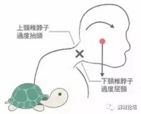 新加坡学生族和上班族都要注意了！再不小心就成“乌龟颈”啦~~