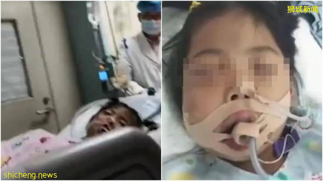 5歲女童拔牙後腦死亡!你還敢隨便在新加坡給孩子拔牙嗎