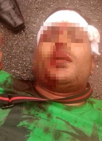 小印度砍人血案领头男认罪 被判8年改造性监禁 鞭24下 