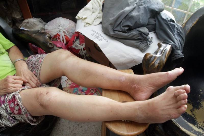 撞伤华妇没援助？ 杨美盈：她认错人了！