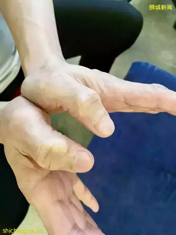 大马按摩师15年靠手吃饭 养出一对大学生儿女