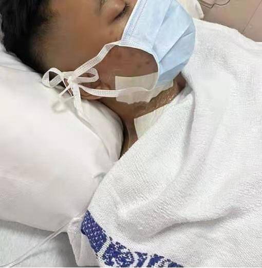 新加坡有这么乱吗?18岁男孩在外吃饭无缘无故就被酒瓶刺伤