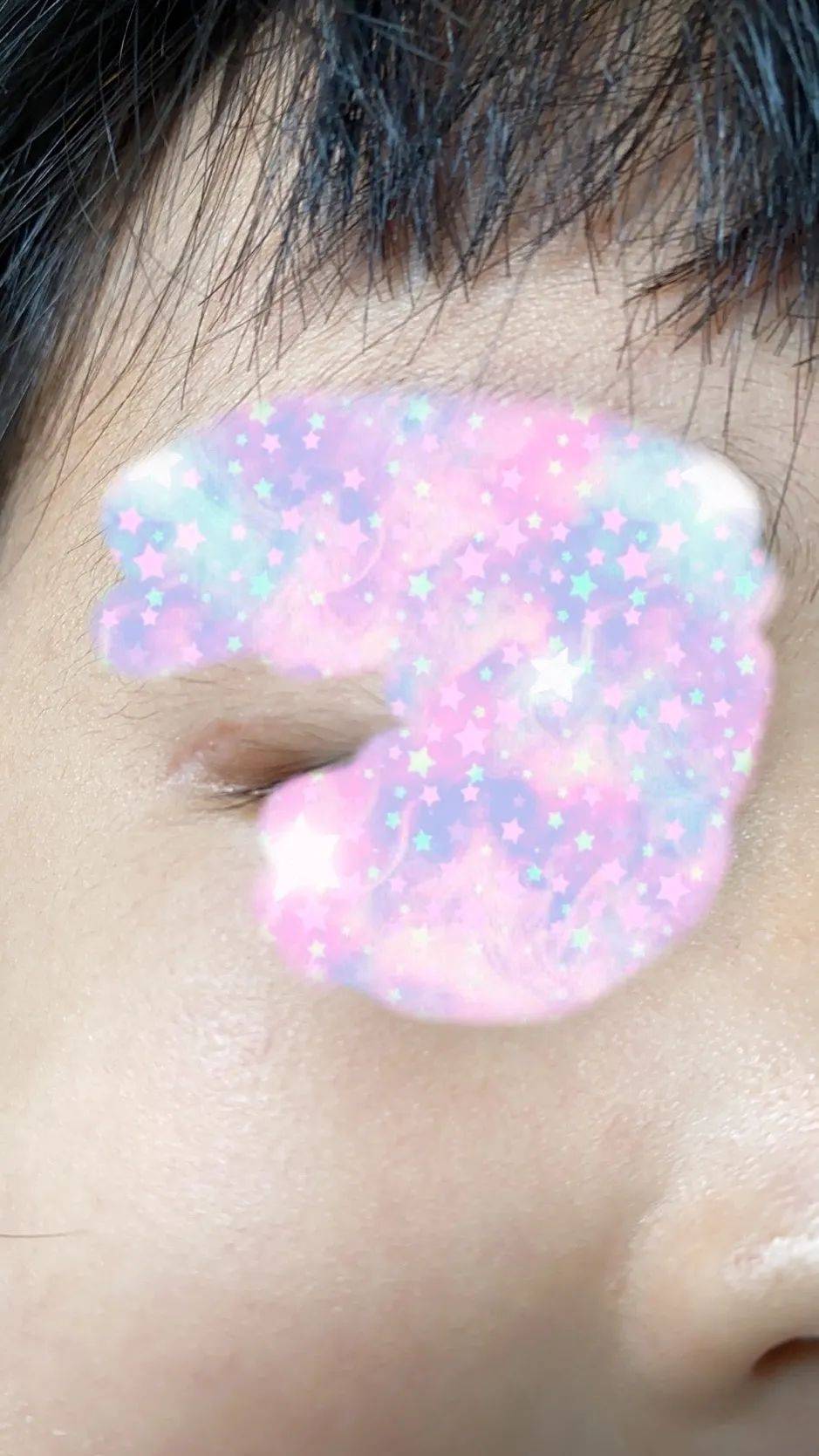 求助:2岁女儿眼睛在新加坡游乐场受重伤!1万多新治疗费!工作人员拒不负责!怎么办