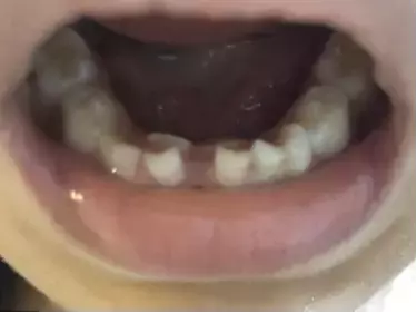 在全球最貴的新加坡，怎麽看病才能省錢？我女兒看病的這些事