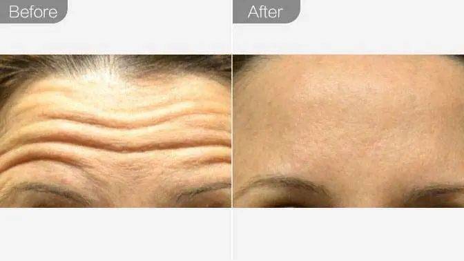 为什么那么多中国人来到新加坡后,变丑了