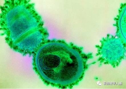 新加坡这个病菌感染倍增,严重甚至致命!多名病患为65岁或以上