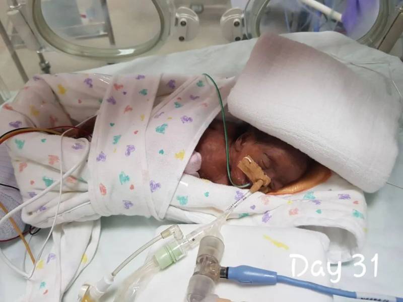 新加坡最輕早産兒僅345克，花了20多萬新幣才救活！新加坡看病到底有多貴