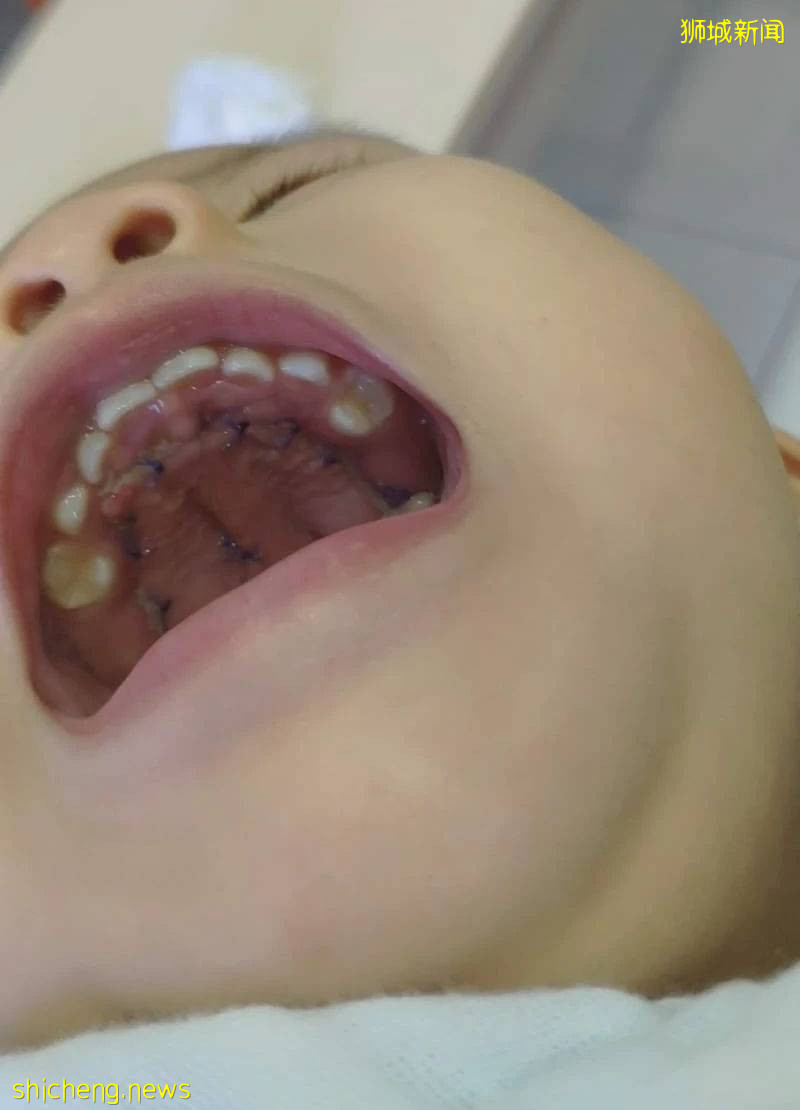 淚目!眼癌、腭裂、呼吸困難……我的寶寶在新加坡剛出生,就開始迎接挑戰