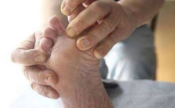 小坡岛科研 新管大开发智能糖尿病足筛查仪器