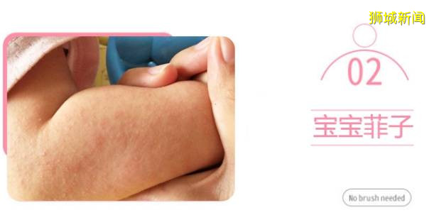 新加坡骨痛熱病例再創新高!如何保護自己和家人