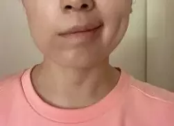 新加坡再發現一種後遺症！口齒不清、閉眼困難！3天後，一波新政出爐備戰"第5波"