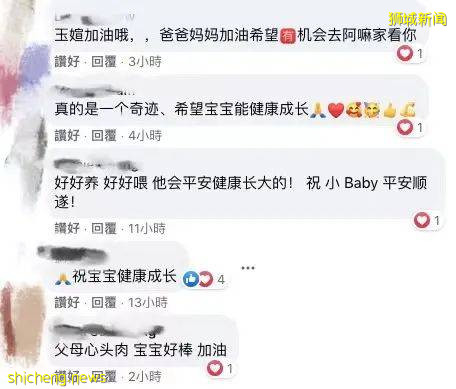 全世界最輕早産兒在新加坡出生,住院13個月後成功回家