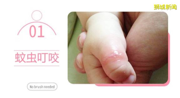 新加坡骨痛熱嚴重！這些防蚊防曬品必備，4折起