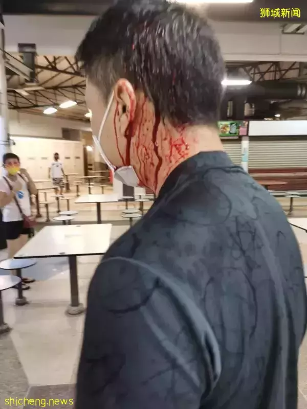 抢生意惹祸? 摊贩遭棍袭 螺钉插头缝9针
