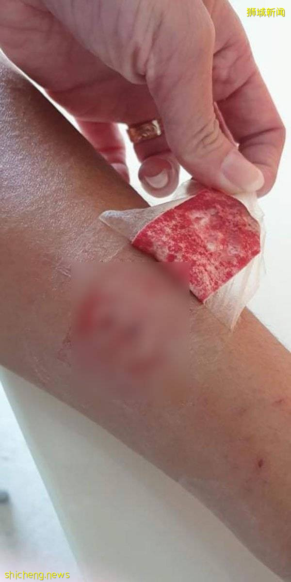 狗咬狗!主人互罵 誰對誰錯