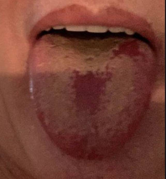 新加坡机场员工紧急检测!曝感染新冠后可能会出现这14种症状