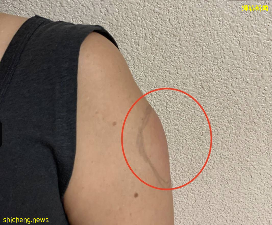 “打疫苗後照樣感染，有什麽意義？”，新加坡衛生部長回應來了