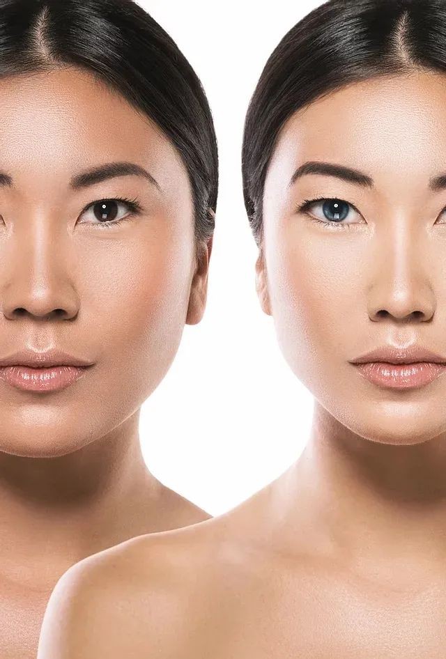 冻龄女明星偷偷都在做的那些热门「医美项目」!!你不想试试吗?