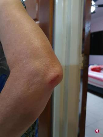 上巴士未坐穩 車長即開車 阿嫲失衡跌傷