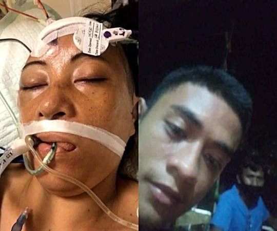 骑脚车摔倒脑出血  女佣昏迷6天苏醒