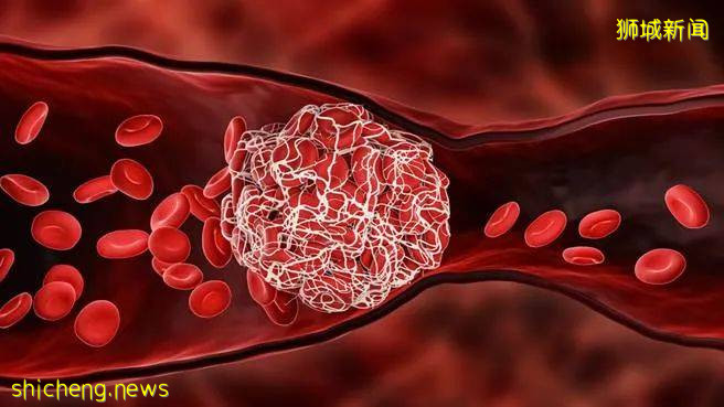 新加坡10人疑打完疫苗后出现脑静脉血栓!科兴预约又爆满