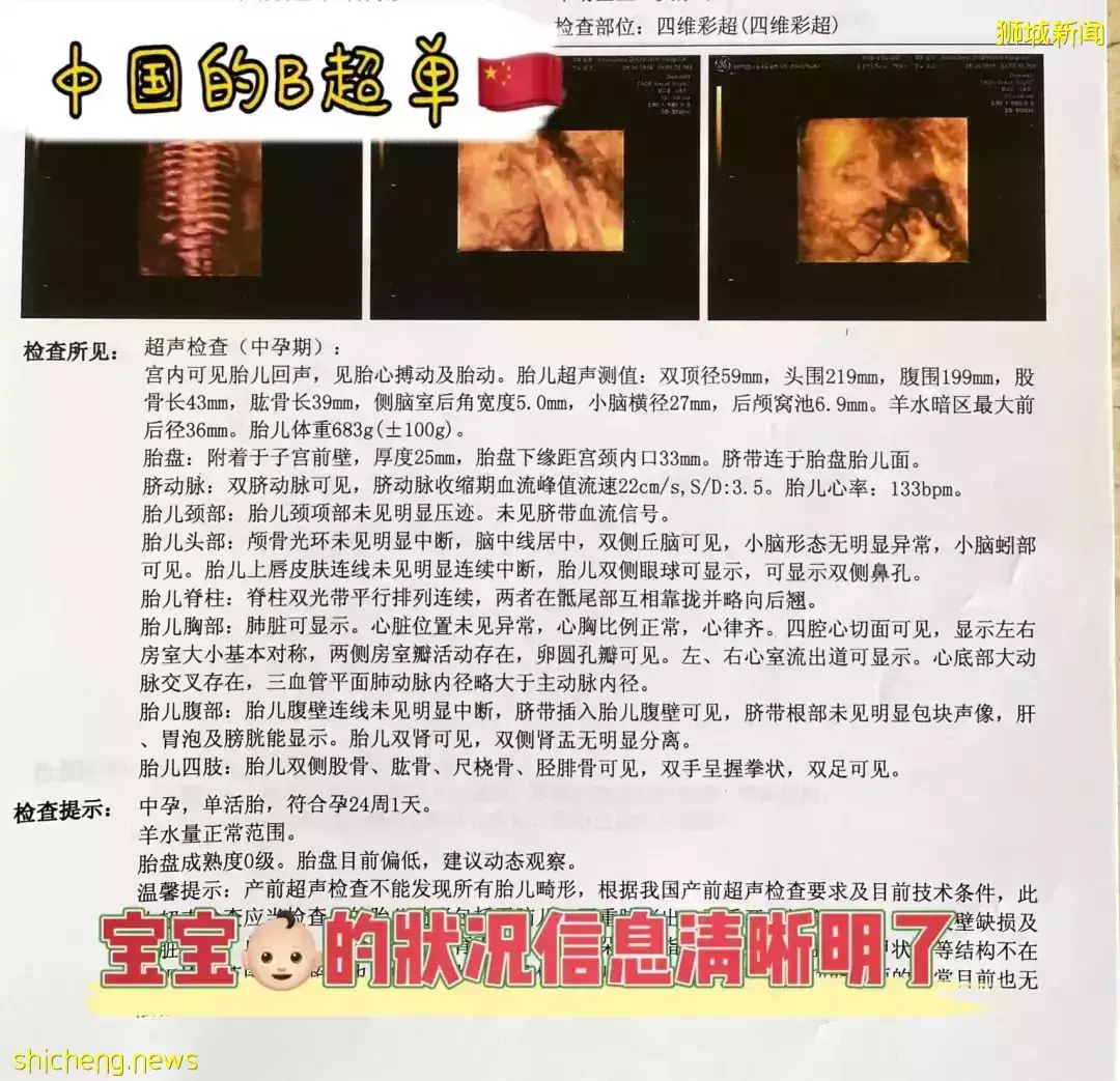 中國生娃 VS 新加坡生娃，媽媽親曆大對比！你覺得在哪生更好