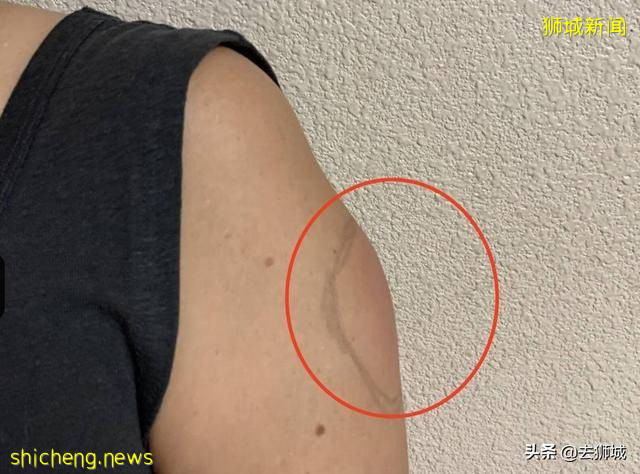 中国疫苗在哪?美国疫苗在新加坡闯祸,医护接种后齐染病