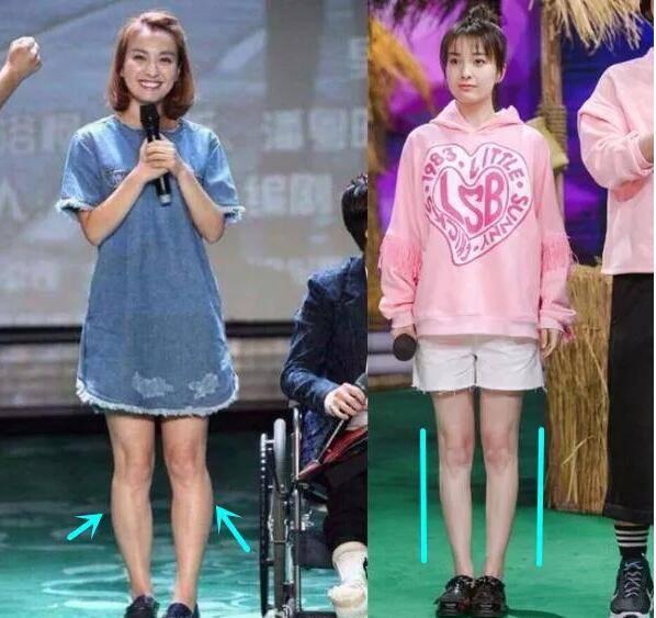 新加坡最新研究：“萝卜腿”难看、但比“筷子腿”保命