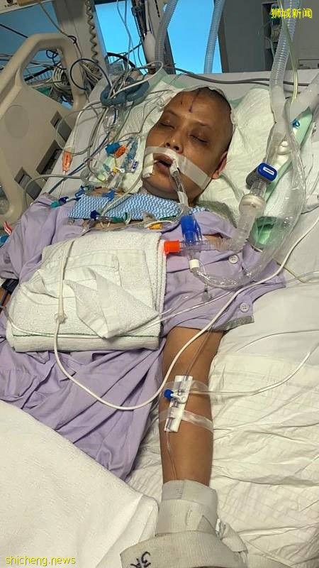 主仆情深！ 女佣脑瘤爆裂 雇主扛12万新币医药费 