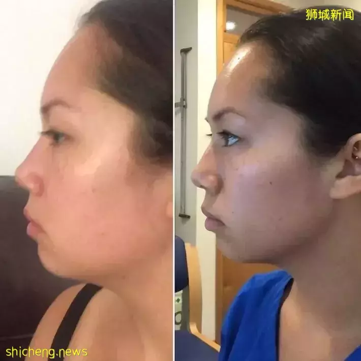 一年一度GSS大促開始啦！解鎖寶藏美容儀隱藏折扣獨家秘笈，超多熱門型號美容儀超低價帶回家