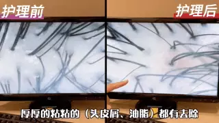 不到一折神价格体验！舒服到要睡着的头皮滋养护理我来啦！超过45年中医头皮护理业界经验！新加坡脱发、油发救星