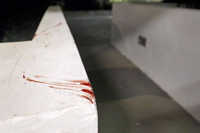 多人合救才趕走 野性大發 野豬咬傷人