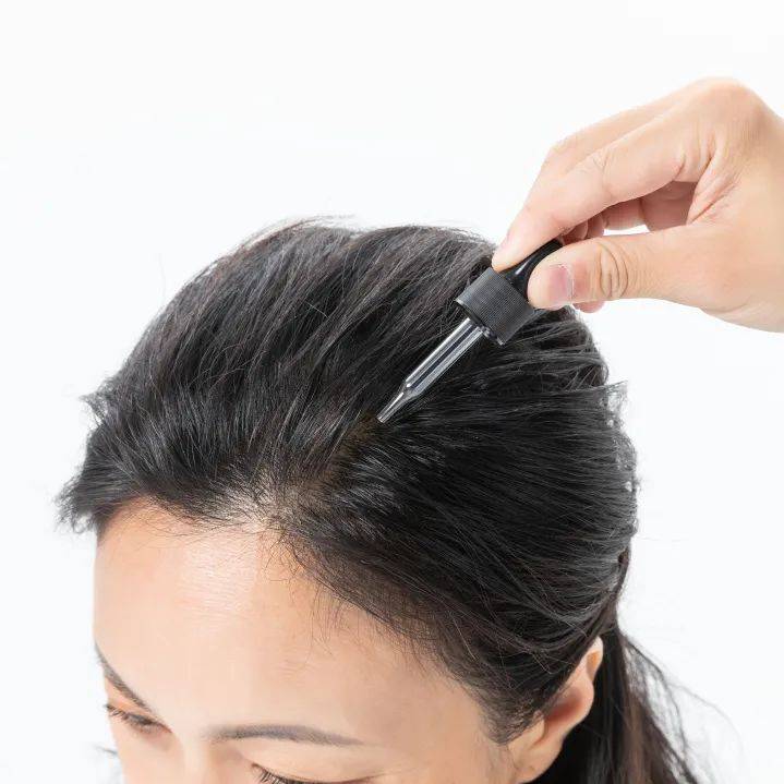 獅城這些“禿”如其來的煩惱,讓它幫你解決