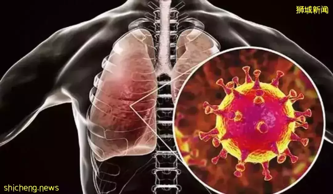 新冠病毒傳播又有新途徑?診所反饋:新加坡患者後遺症增加