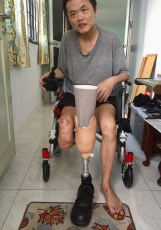 董事新手上路撞倒摩哆 骑士被截肢 仍选择原谅司机