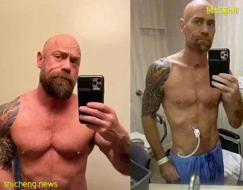 在新加坡,医疗保险都保什么