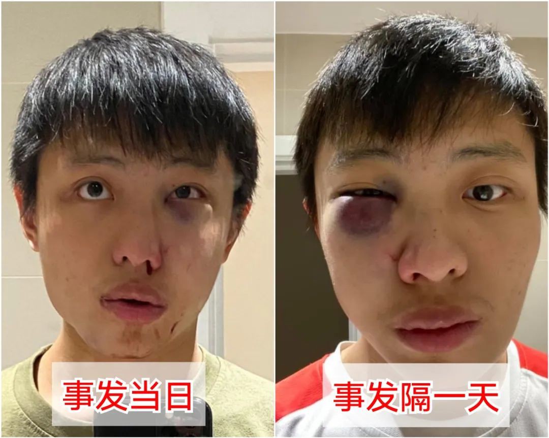 英国警方公开4青年照片,他们曾歧视并围殴新加坡留学生