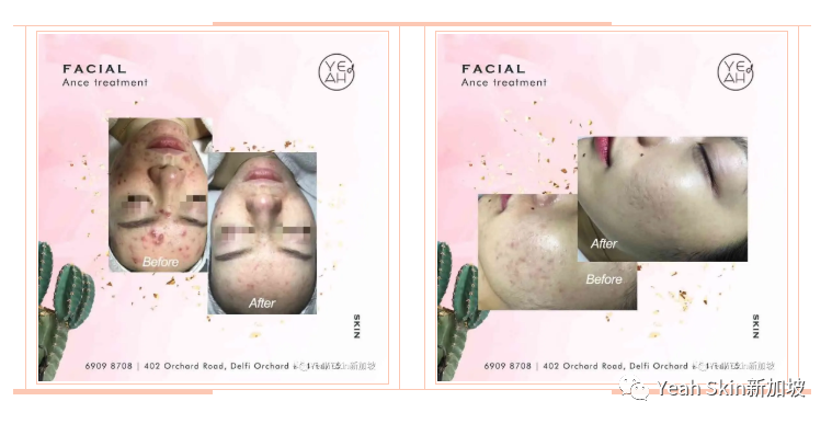 Get《乘风破浪的姐姐》护肤秘籍！会保养的女人最好命！