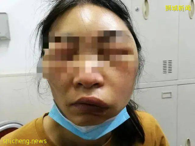 輝瑞/莫德納接種者，9403人副作用 過去三個月，驟增6千多起