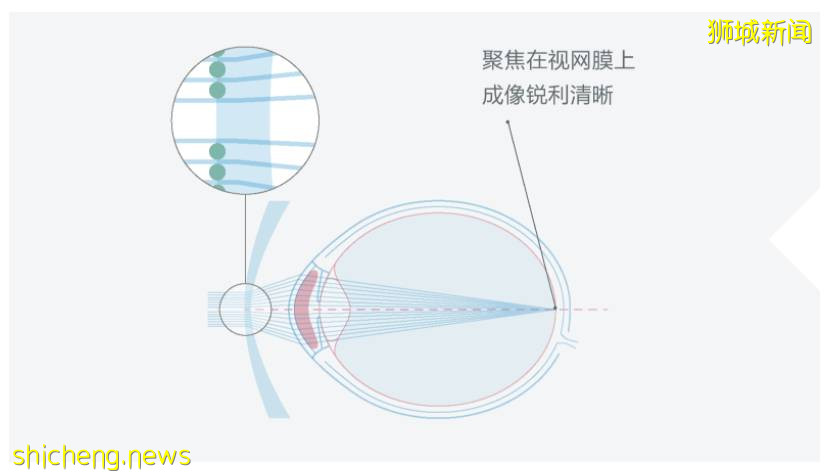 喜大普奔！防控孩子近視的“黑科技”鏡片，終于來新加坡啦