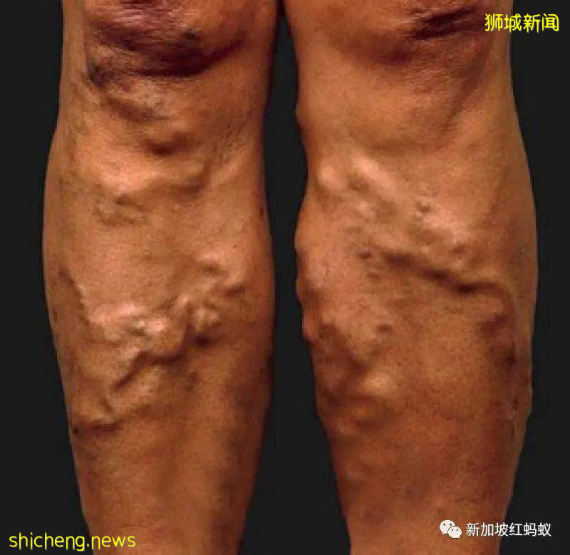 销售员在没顾客时也须长时间站立合理吗?读者来函引发热议