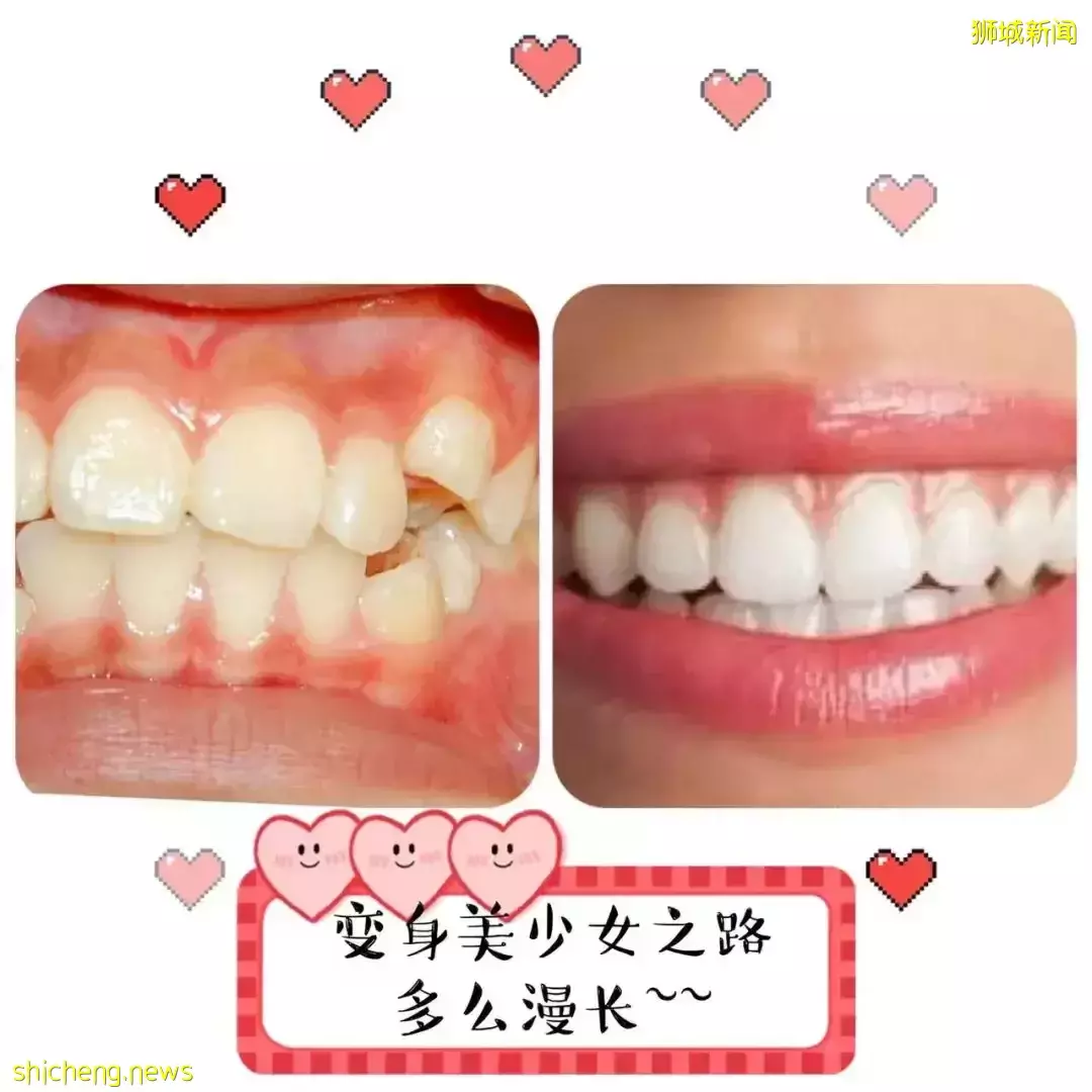 “我的新加坡整牙记：搬家、拒诊、贵……找个满意的医生好难！”