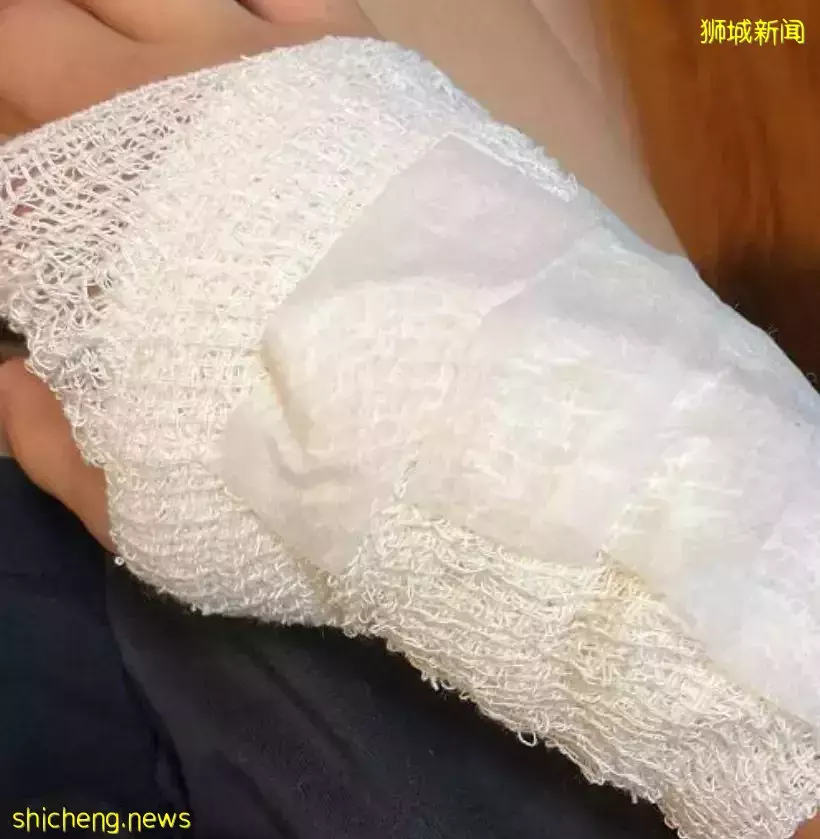 震惊!这名学生在新加坡被狂砍6刀,缝了几十针!警方高层:芽笼是潜在火药桶