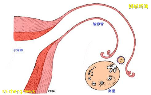 救命!家里的熊孩子不能再多了!新加坡这些避孕方法赶紧收好